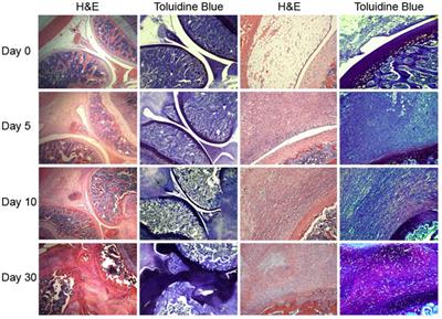 Gene Therapy in Orthopaedics: Progress and Challenges in Pre-Clinical Development and Translation